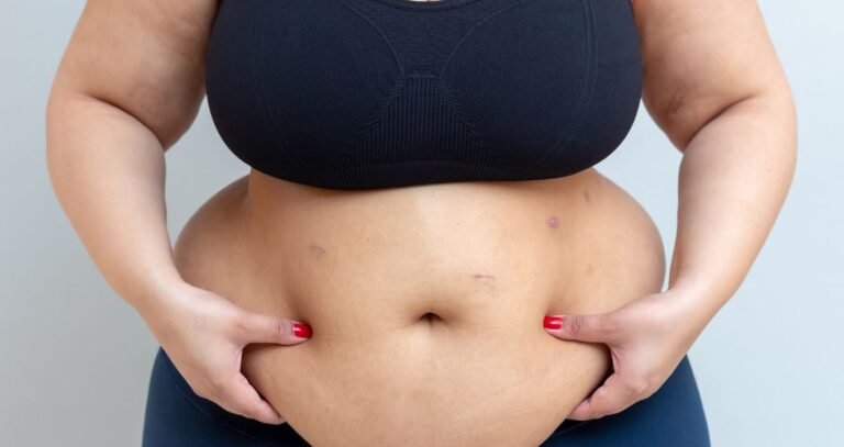 A Holistic Approach to Weight Loss: More Than Just Calories